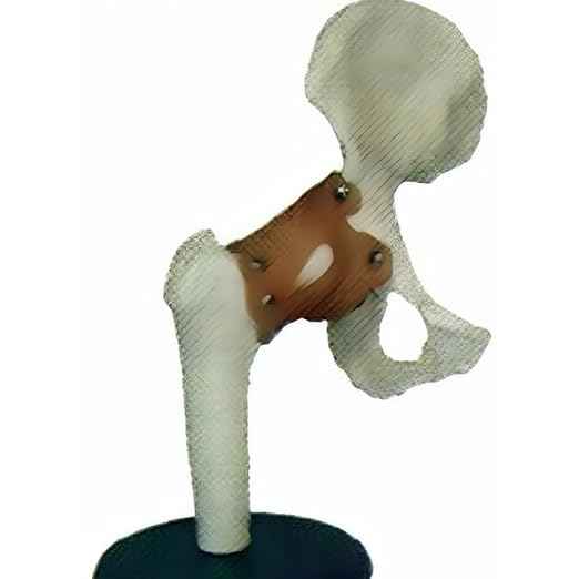 Hip Joint Model with Artificial Ligaments Anatomical Human Skeleton, Flexible Durable Design for Medical Education, Anatomy Study, Teaching Tool