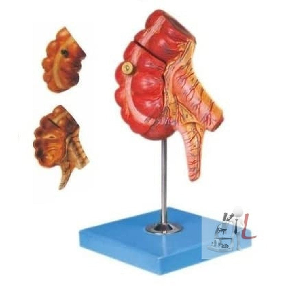 Caecum and Appendix, EnlScifaed-