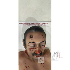 Road accident forensic model - Laboratorydeal