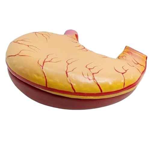 Stomach Gastric Enlargement Model – Human Anatomy Educational Tool for Medical Students, Teaching, Demonstrations & Healthcare Learning Aid