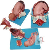 Child Birth Demonstration Model- 