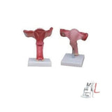 Scifa  Magnified Uterus Model- 