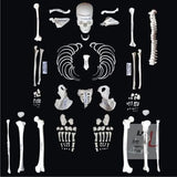 Disarticulated Skeleton Human (IMP.), Disarticulated Bone Set- 